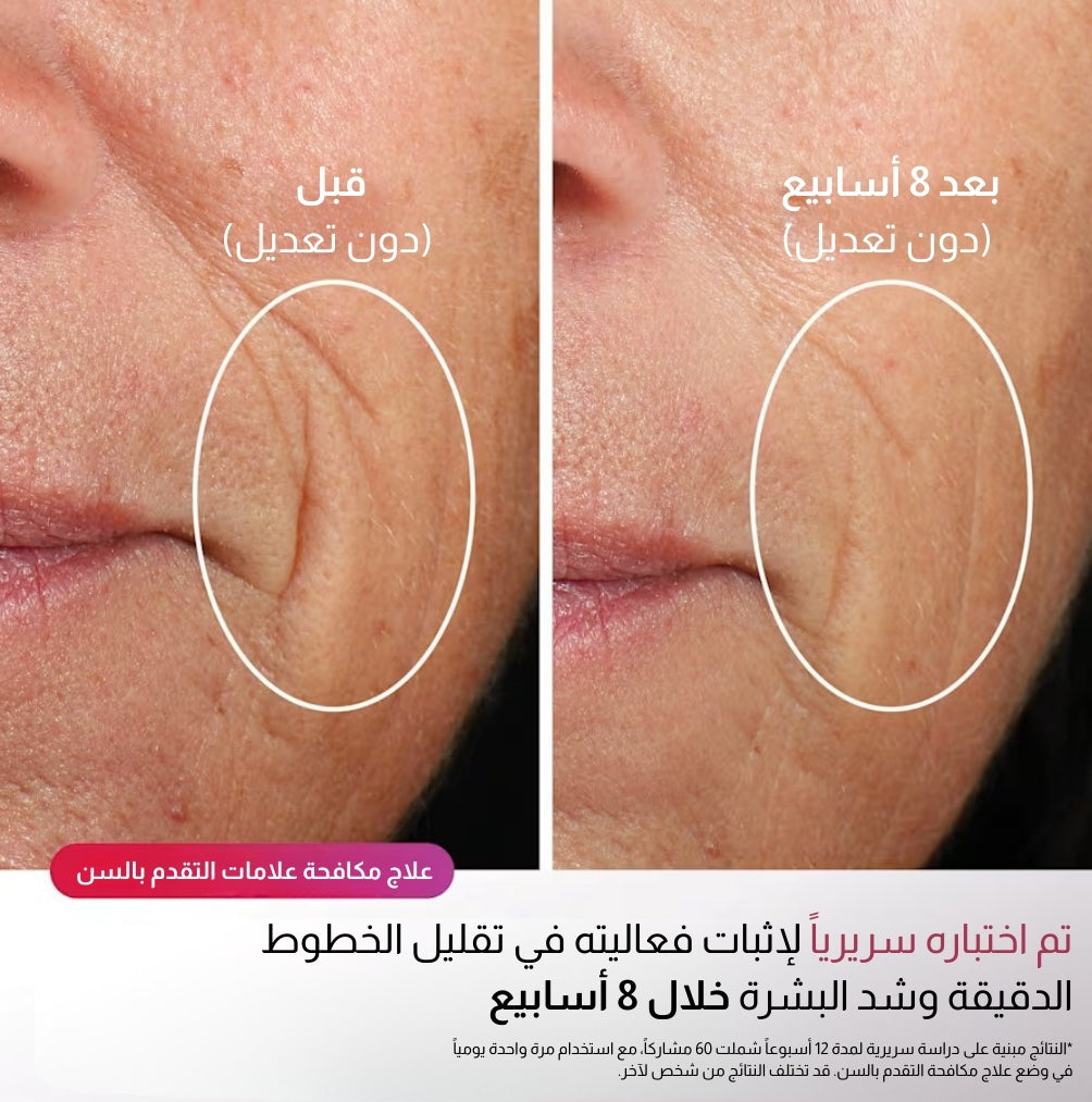 Shark CryoGlow LED Mask