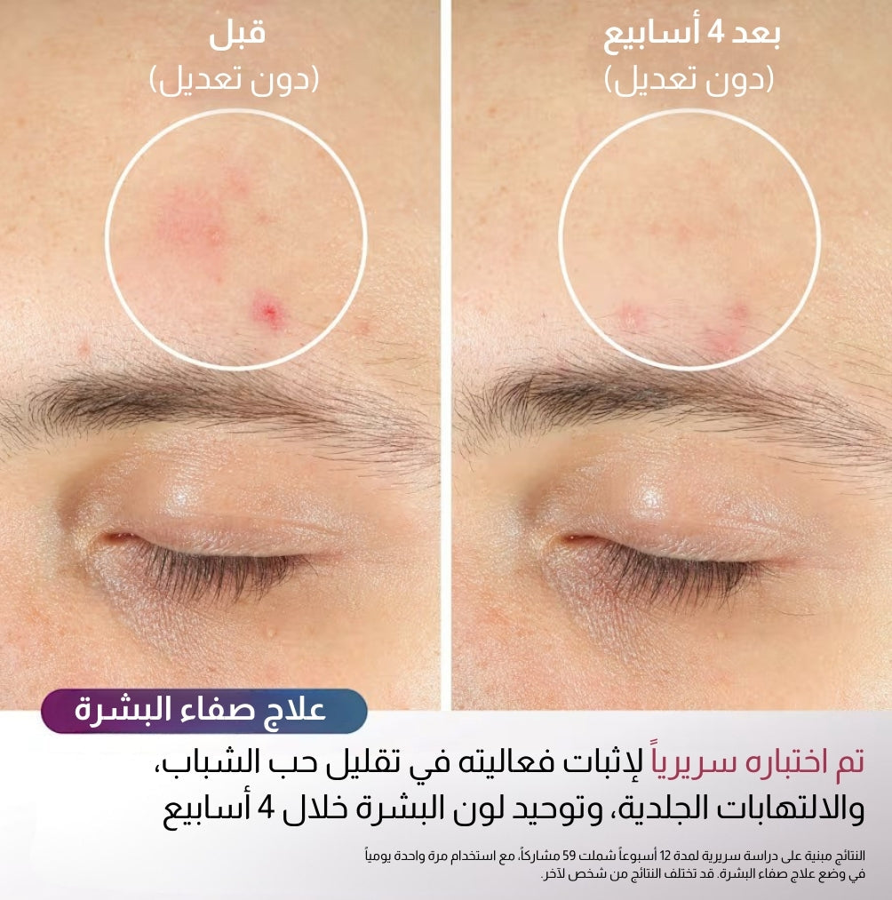 Shark CryoGlow LED Mask