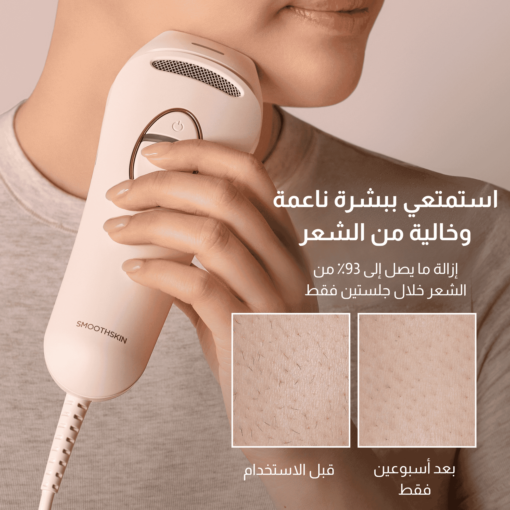 Smoothskin PureSwitch IPL