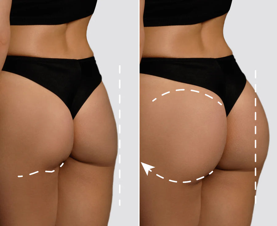 <p>Anti-Sag Effect</p>