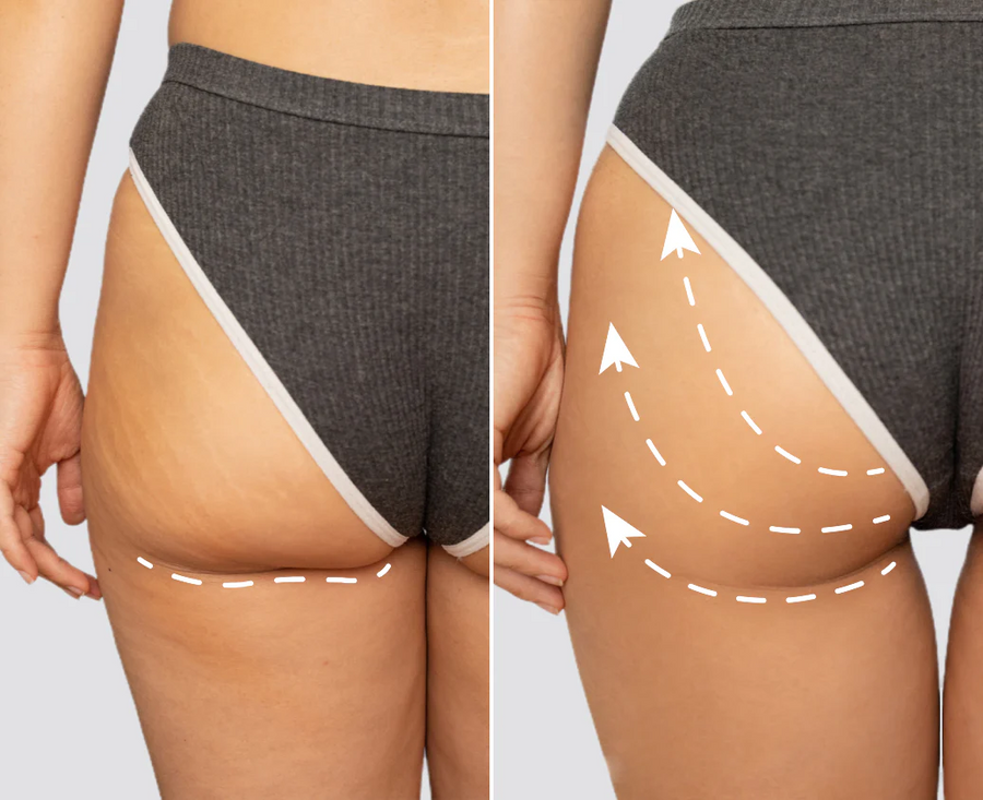 <p>Lift & Sculpt</p>